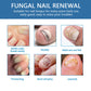 Nagelriemolie voor nagels