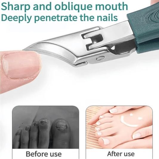 🔥Door podologen aanbevolen nagelknipper – Ergonomisch, schuin ontwerp voor teennagels en ingegroeide nagels – Tijdelijke aanbieding met 50% korting